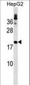 LHFP Antibody - LHFP Antibody western blot of HepG2 cell line lysates (35 ug/lane). The LHFP antibody detected the LHFP protein (arrow).