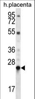 LHFPL1 Antibody - LHFPL1 Antibody western blot of human placenta tissue lysates (35 ug/lane). The LHFPL1 antibody detected the LHFPL1 protein (arrow).