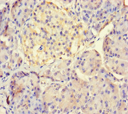 LHFPL1 Antibody - Immunohistochemistry of paraffin-embedded human pancreatic tissue using LHFPL1 Antibody at dilution of 1:100
