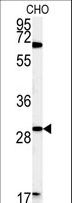 LHFPL2 Antibody - Western blot of LHPL2 Antibody in CHO cell line lysates (35 ug/lane). LHPL2 (arrow) was detected using the purified antibody.