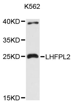 LHFPL2 Antibody - Western blot analysis of extracts of K-562 cells, using LHFPL2 antibody at 1:3000 dilution. The secondary antibody used was an HRP Goat Anti-Rabbit IgG (H+L) at 1:10000 dilution. Lysates were loaded 25ug per lane and 3% nonfat dry milk in TBST was used for blocking. An ECL Kit was used for detection and the exposure time was 90s.