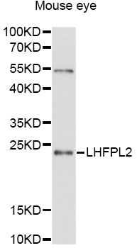 LHFPL2 Antibody - Western blot analysis of extracts of mouse eye, using LHFPL2 antibody at 1:3000 dilution. The secondary antibody used was an HRP Goat Anti-Rabbit IgG (H+L) at 1:10000 dilution. Lysates were loaded 25ug per lane and 3% nonfat dry milk in TBST was used for blocking. An ECL Kit was used for detection and the exposure time was 90s.
