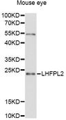 LHFPL2 Antibody - Western blot analysis of extracts of mouse eye, using LHFPL2 antibody at 1:3000 dilution. The secondary antibody used was an HRP Goat Anti-Rabbit IgG (H+L) at 1:10000 dilution. Lysates were loaded 25ug per lane and 3% nonfat dry milk in TBST was used for blocking. An ECL Kit was used for detection and the exposure time was 90s.