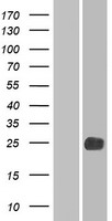 LHFPL2 Protein - Western validation with an anti-DDK antibody * L: Control HEK293 lysate R: Over-expression lysate