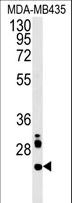 LHFPL3 Antibody - LHPL3 Antibody western blot of MDA-MB435 cell line lysates (15 ug/lane). The LHPL3 antibody detected the LHPL3 protein (arrow).