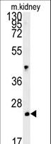 LHFPL3 Antibody - LHPL3 Antibody western blot of mouse kidney tissue lysates (15 ug/lane). The LHPL3 antibody detected the LHPL3 protein (arrow).