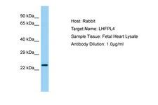 LHFPL4 Antibody -  This image was taken for the unconjugated form of this product. Other forms have not been tested.