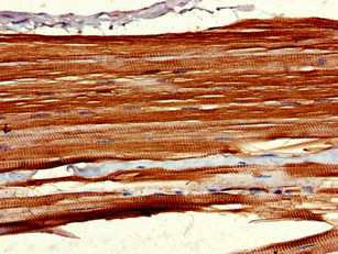 LHFPL5 Antibody - Immunohistochemistry of paraffin-embedded human skeletal muscle tissue at dilution of 1:100