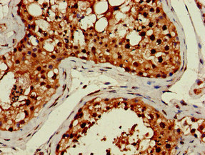 LHFPL5 Antibody - Immunohistochemistry of paraffin-embedded human testis tissue at dilution of 1:100