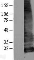 LHFPL5 Protein - Western validation with an anti-DDK antibody * L: Control HEK293 lysate R: Over-expression lysate
