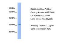 LHPP Antibody -  This image was taken for the unconjugated form of this product. Other forms have not been tested.