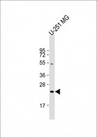 LHPP Antibody - Anti-LHPP Antibody (Center) at 1:2000 dilution + U-251 MG whole cell lysate Lysates/proteins at 20 µg per lane. Secondary Goat Anti-Rabbit IgG, (H+L), Peroxidase conjugated at 1/10000 dilution. Predicted band size: 29 kDa Blocking/Dilution buffer: 5% NFDM/TBST.