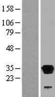 LHPP Protein - Western validation with an anti-DDK antibody * L: Control HEK293 lysate R: Over-expression lysate