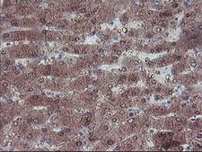 LHX1 Antibody - IHC of paraffin-embedded Human liver tissue using anti-LHX1 mouse monoclonal antibody.