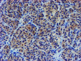LHX1 Antibody - IHC of paraffin-embedded Human pancreas tissue using anti-LHX1 mouse monoclonal antibody. (Heat-induced epitope retrieval by 10mM citric buffer, pH6.0, 100C for 10min).