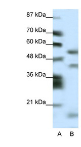LHX1 Antibody - LHX1 antibody Western blot of HepG2 cell lysate. This image was taken for the unconjugated form of this product. Other forms have not been tested.