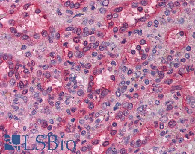 LHX1 Antibody - Anti-LHX1 antibody IHC of human spleen. Immunohistochemistry of formalin-fixed, paraffin-embedded tissue after heat-induced antigen retrieval. Antibody concentration 5 ug/ml.  This image was taken for the unconjugated form of this product. Other forms have not been tested.