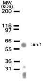 LHX1 Antibody - Western blot of LIM-1 in muscle lysate with antibody at 1:500 dilution. A protein band of an approximate molecular weight of 60 kD was detected.