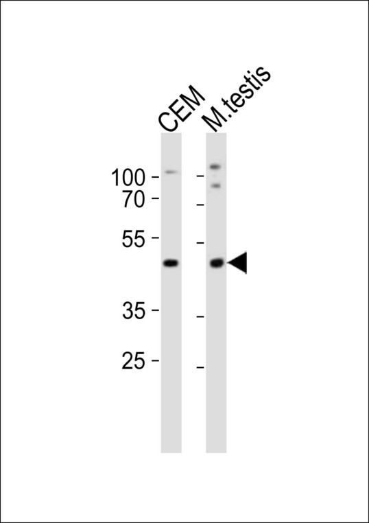 LHX1 Antibody - Western blot of lysates from CEM cell line, mouse testis tissue lysate (from left to right), using Lhx1 antibody diluted at 1:1000 at each lane. A goat anti-rabbit IgG H&L (HRP) at 1:10000 dilution was used as the secondary antibody. Lysates at 20 ug per lane.