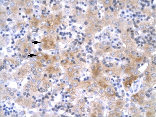 LHX1 Antibody - LHX1 antibody P100851_T100-NP_005559-LHX1 (LIM homeobox 1) Antibody was used in IHC to stain formalin-fixed, paraffin-embedded human liver.  This image was taken for the unconjugated form of this product. Other forms have not been tested.