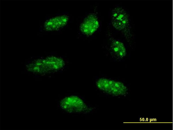 LHX1 Antibody - Immunofluorescence of monoclonal antibody to LHX1 on HeLa cell. [antibody concentration 10 ug/ml].