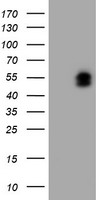 LHX1 Antibody - HEK293T cells were transfected with the pCMV6-ENTRY control (Left lane) or pCMV6-ENTRY LHX1 (Right lane) cDNA for 48 hrs and lysed. Equivalent amounts of cell lysates (5 ug per lane) were separated by SDS-PAGE and immunoblotted with anti-LHX1.