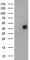 LHX1 Antibody - HEK293T cells were transfected with the pCMV6-ENTRY control (Left lane) or pCMV6-ENTRY LHX1 (Right lane) cDNA for 48 hrs and lysed. Equivalent amounts of cell lysates (5 ug per lane) were separated by SDS-PAGE and immunoblotted with anti-LHX1.