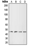 LHX1 Antibody - Western blot analysis of LHX1 expression in HEK293T (A); HepG2 (B); SP2/0 (C); H9C2 (D) whole cell lysates.