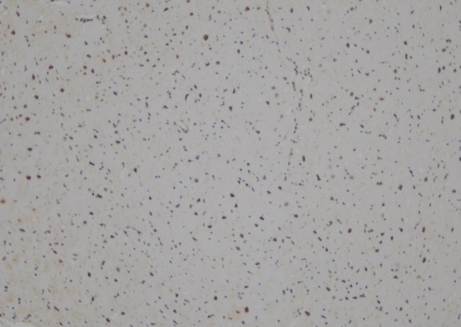 LHX1 Antibody - 1:100 staining human heart tissue by IHC-P. The sample was formaldehyde fixed and a heat mediated antigen retrieval step in citrate buffer was performed. The sample was then blocked and incubated with the antibody for 1.5 hours at 22°C. An HRP conjugated goat anti-rabbit antibody was used as the secondary.