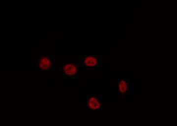LHX1 Antibody - Staining HepG2 cells by IF/ICC. The samples were fixed with PFA and permeabilized in 0.1% Triton X-100, then blocked in 10% serum for 45 min at 25°C. The primary antibody was diluted at 1:200 and incubated with the sample for 1 hour at 37°C. An Alexa Fluor 594 conjugated goat anti-rabbit IgG (H+L) Ab, diluted at 1/600, was used as the secondary antibody.