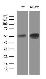 LHX2 Antibody - Western blot analysis of extracts. (35ug) from 2 different cell lines by using anti-LHX2 monoclonal antibody. (1:500)