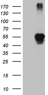 LHX2 Antibody - HEK293T cells were transfected with the pCMV6-ENTRY control. (Left lane) or pCMV6-ENTRY LHX2. (Right lane) cDNA for 48 hrs and lysed. Equivalent amounts of cell lysates. (5 ug per lane) were separated by SDS-PAGE and immunoblotted with anti-LHX2. (1:2000)