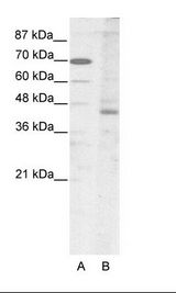 LHX2 Antibody - A: Marker, B: HepG2 Cell Lysate.  This image was taken for the unconjugated form of this product. Other forms have not been tested.