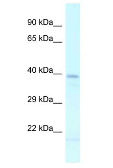 LHX2 Antibody - LHX2 antibody Western Blot of Mouse Thymus. Antibody dilution: 1 ug/ml.  This image was taken for the unconjugated form of this product. Other forms have not been tested.