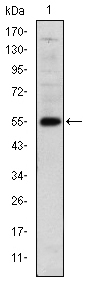 LHX2 Antibody - Western blot using LHX2 monoclonal antibody against human LHX2 (AA: 200-406) recombinant protein. (Expected MW is 55 kDa)