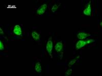 LHX2 Antibody - Immunostaining analysis in HeLa cells. HeLa cells were fixed with 4% paraformaldehyde and permeabilized with 0.1% Triton X-100 in PBS. The cells were immunostained with anti-LHX2 mAb.