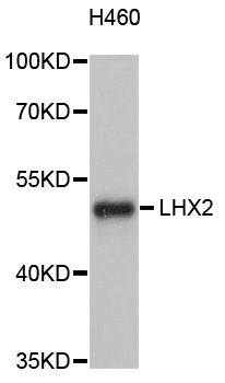 LHX2 Antibody - Western blot analysis of extracts of H460 cells, using LHX2 antibody at 1:1000 dilution. The secondary antibody used was an HRP Goat Anti-Rabbit IgG (H+L) at 1:10000 dilution. Lysates were loaded 25ug per lane and 3% nonfat dry milk in TBST was used for blocking. An ECL Kit was used for detection and the exposure time was 90s.