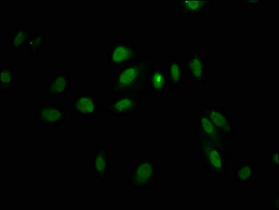 LHX2 Antibody - Immunofluorescence staining of Hela cells at a dilution of 1:100, counter-stained with DAPI. The cells were fixed in 4% formaldehyde, permeabilized using 0.2% Triton X-100 and blocked in 10% normal Goat Serum. The cells were then incubated with the antibody overnight at 4 °C.The secondary antibody was Alexa Fluor 488-congugated AffiniPure Goat Anti-Rabbit IgG (H+L) .