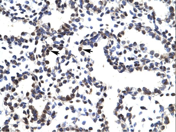 LHX3 Antibody - LHX3 antibody ARP33643_T100-NP_055379-LHX3 (LIM homeobox 3) Antibody was used in IHC to stain formalin-fixed, paraffin-embedded human lung.  This image was taken for the unconjugated form of this product. Other forms have not been tested.