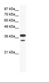 LHX3 Antibody - Jurkat Cell Lysate.  This image was taken for the unconjugated form of this product. Other forms have not been tested.