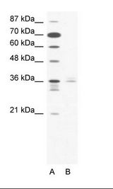 LHX3 Antibody - A: Marker, B: Jurkat Cell Lysate.  This image was taken for the unconjugated form of this product. Other forms have not been tested.