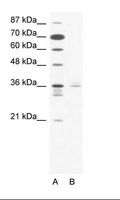 LHX3 Antibody - A: Marker, B: Jurkat Cell Lysate.  This image was taken for the unconjugated form of this product. Other forms have not been tested.