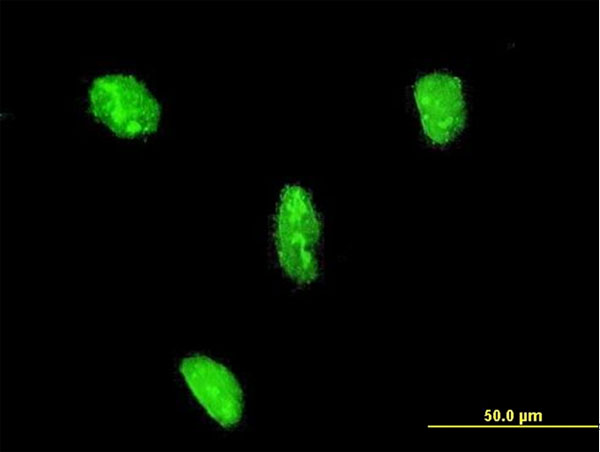 LHX3 Antibody - Immunofluorescence of monoclonal antibody to LHX3 on HeLa cell . [antibody concentration 10 ug/ml]