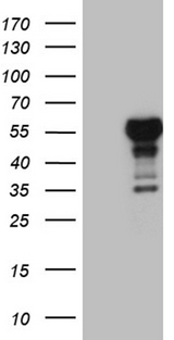 LHX4 Antibody - HEK293T cells were transfected with the pCMV6-ENTRY control. (Left lane) or pCMV6-ENTRY LHX4. (Right lane) cDNA for 48 hrs and lysed. Equivalent amounts of cell lysates. (5 ug per lane) were separated by SDS-PAGE and immunoblotted with anti-LHX4. (1:2000)