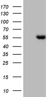LHX4 Antibody - HEK293T cells were transfected with the pCMV6-ENTRY control. (Left lane) or pCMV6-ENTRY LHX4. (Right lane) cDNA for 48 hrs and lysed. Equivalent amounts of cell lysates. (5 ug per lane) were separated by SDS-PAGE and immunoblotted with anti-LHX4. (1:2000)