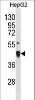 LHX4 Antibody - LHX4 Antibody western blot of HepG2 cell line lysates (35 ug/lane). The LHX4 antibody detected the LHX4 protein (arrow).