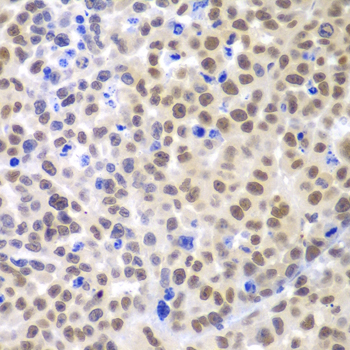 LHX4 Antibody - Immunohistochemistry of paraffin-embedded mouse cancer using LHX4 antibody at dilution of 1:100 (x400 lens).