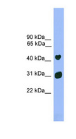 LHX5 Antibody - LHX5 antibody Western blot of Mouse Heart lysate. This image was taken for the unconjugated form of this product. Other forms have not been tested.