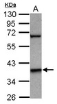 LHX5 Antibody - Sample (30 ug of whole cell lysate) A: A431 10% SDS PAGE LHX5 antibody diluted at 1:1000