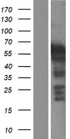 LHX5 Protein - Western validation with an anti-DDK antibody * L: Control HEK293 lysate R: Over-expression lysate